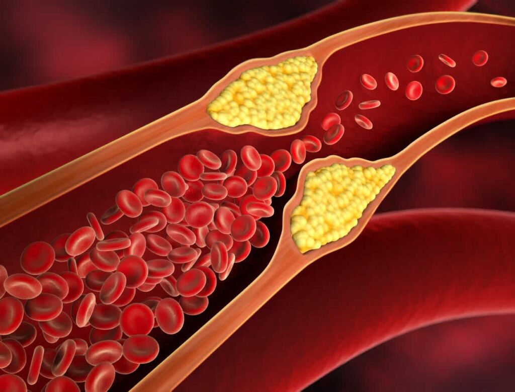 Uống trà Phổ Nhĩ đều đặn có thể hỗ trợ giảm cholesterol xấu, 